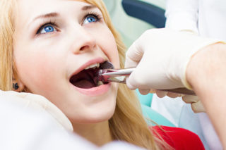 Girl getting tooth extracted
